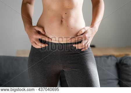 Woman Abdomen With Cesarean Scar. Home Candid Lifestyle. C Section Surgery For Pregnant Woman. Recov