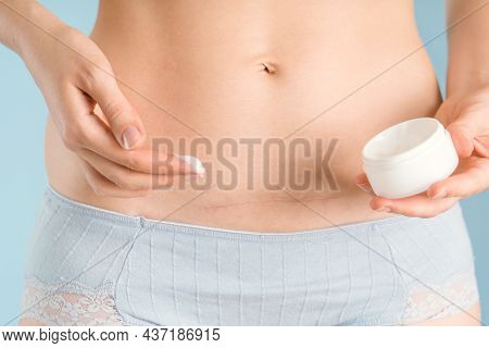 A Woman's Hand Applies Cream To A Stomach With A Cesarean Section Scar, Close-up