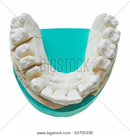 Positive Teeth Cast