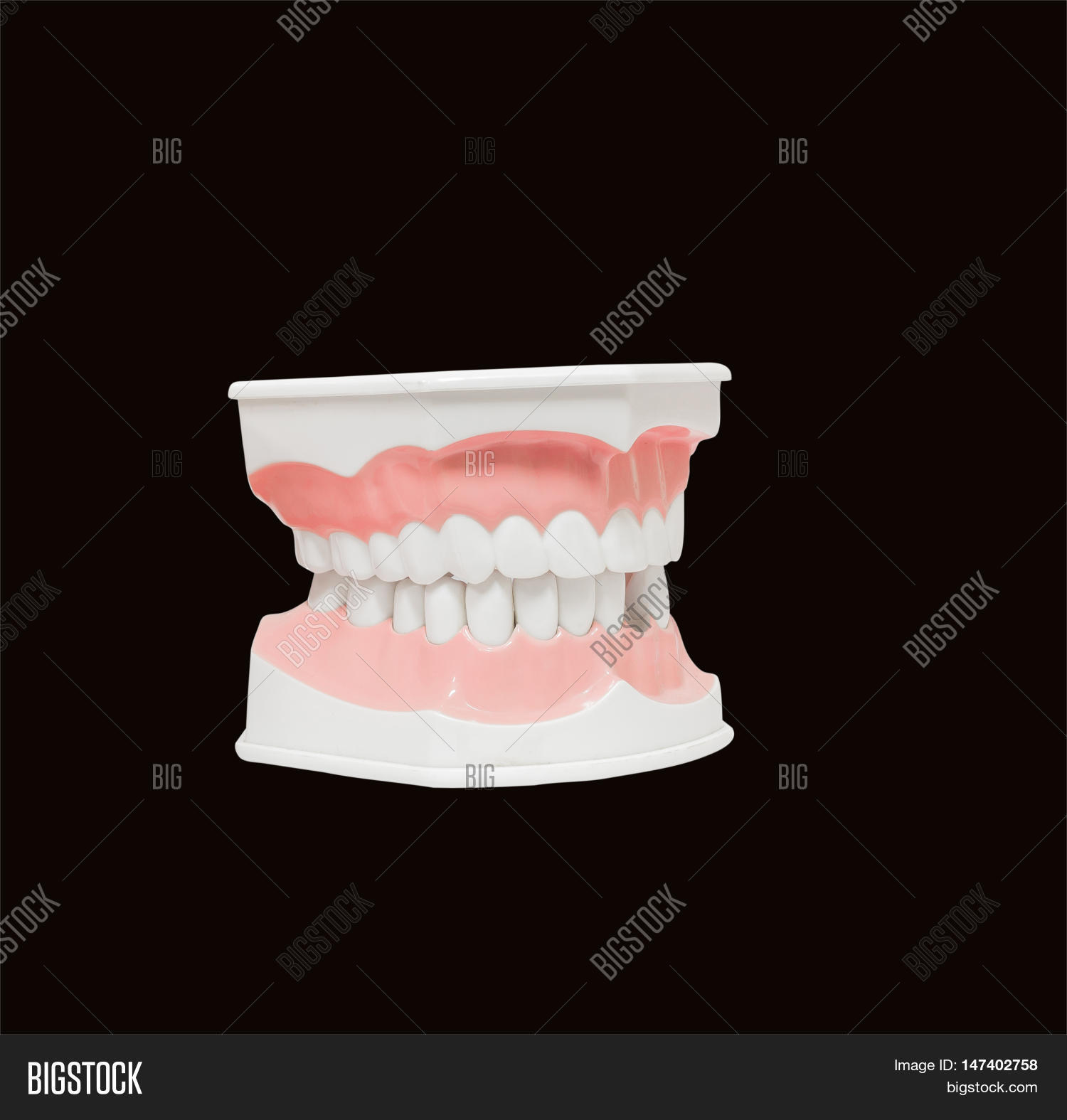 Tooth Model Open Dental Model Teeth Image & Photo (Free Trial) | Bigstock