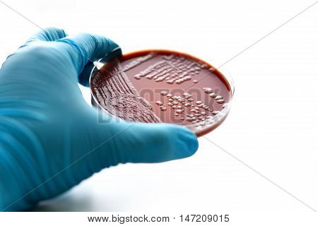 Colonies of bacteria in chocolate agar (culture medium plate)