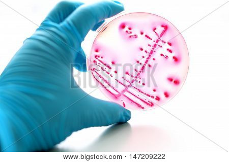 Colonies of bacteria in MacConkey agar (culture medium plate)