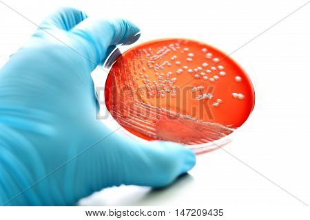 Colonies of bacteria in blood agar (culture medium plate)