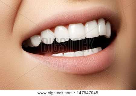 Beautiful Wide Smile Of Young Fresh Woman With Great Healthy Whi