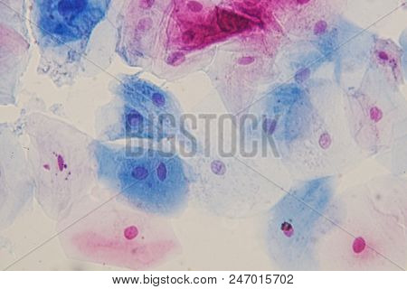 Squamous Epithelial Cells Under Microscope View For Education Histology. Human Tissue.