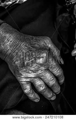 Two hands of an old woman on a knees.Wrinkles of an elderly grandmother.Hands of an old woman with w