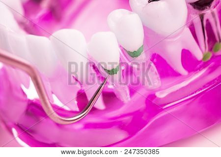 Dentist Cleaning Teeth