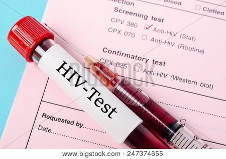 Sample Blood Collection Tube With Hiv Test Label On Hiv Infection Screening Test Form.
