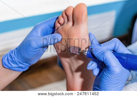 Master During A Pedicure. The Process Of Professional Pedicures. The Wizard In The Mask Causes The G