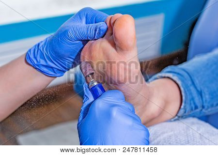 Master During A Pedicure. The Process Of Professional Pedicures. The Wizard In The Mask Causes The G