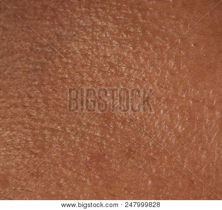 Shin Texture Human Skin Texture Image & Photo (Free Trial) | Bigstock