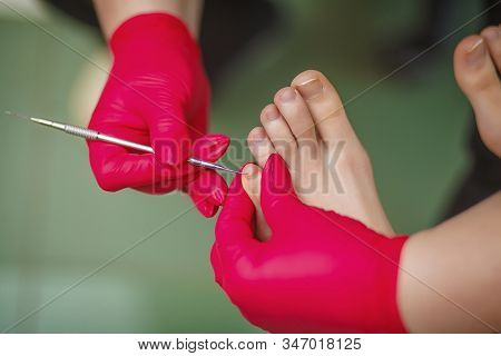 Podiatrist Treating Toenail Fungus. Podology Treatment. Close-up.