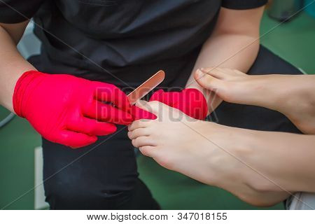 Podiatrist Treating Toenail Fungus. Podology Treatment. Close-up.