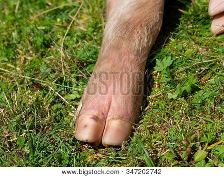 Close Up Of A Pig Foot In The Meadow