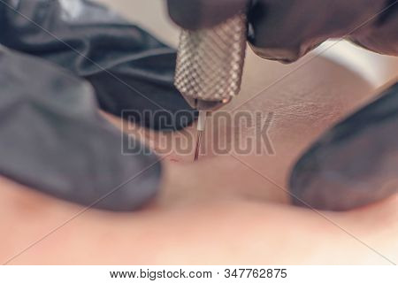 Needle Wrinkle Treatment. Needle Mesotherapy Single Needle Clopse Up.