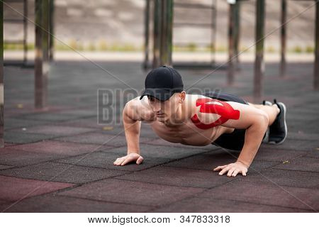 Young European Athlete With Injury Is Training Outdoors. Kinesiology ( Therapeutic, Kinesio, K-tape,
