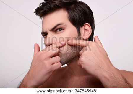 A Close-up Image Of A Handsome Young White Guy With Dark Hair And A Beard Removes The Anane On His C