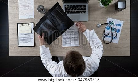 Pulmonologist Looking At Lungs X-ray, Thinking About Diagnosis For Patient