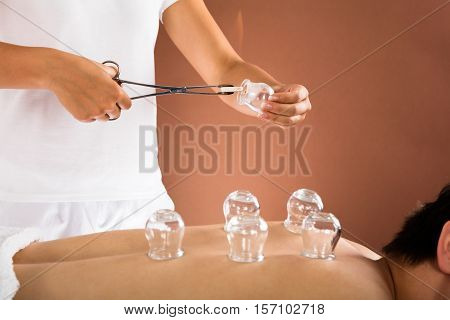 Close-up Of A Therapist Giving Cupping Therapy To Man In Spa