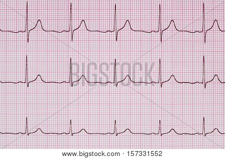 Printed ECG can be used as a background