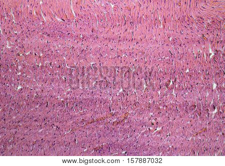 Heart Micrography