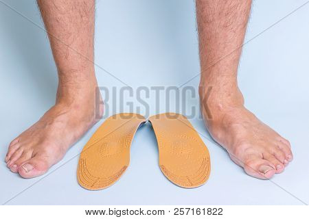 Male Legs With Signs Of Flat Feet And Joints And Orthopedic Insoles On A Blue Background. Front View