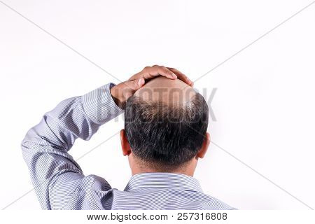 Bald Businessman With His Head On Scalp View From Behind With White Background