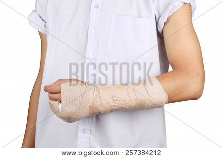 Close Up Of Young Asian Boy With Arm Plaster Fiberglass Cast Covering The Wrist Finger And Arm. Stud