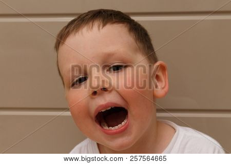 Boy, Child, In A White T-shirt Opened His Mouth On Examination With A Doctor. A Dentist Or An Otolar