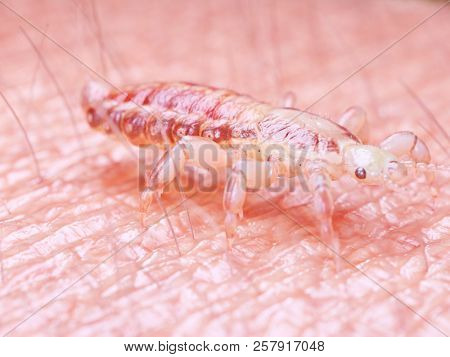 3d rendered illustration of a head louse on human skin