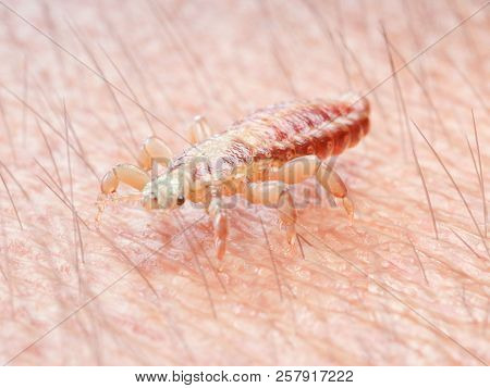 3d rendered illustration of a head louse on human skin