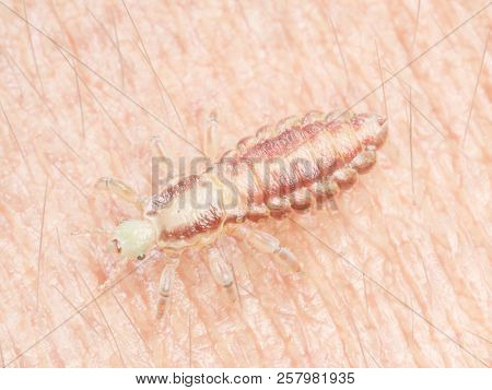 3d rendered medically accurate illustration of a head louse on human skin