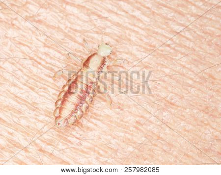 3d rendered medically accurate illustration of a head louse on human skin