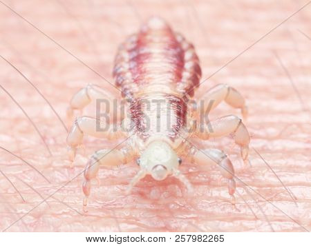 3d rendered medically accurate illustration of a head louse on human skin