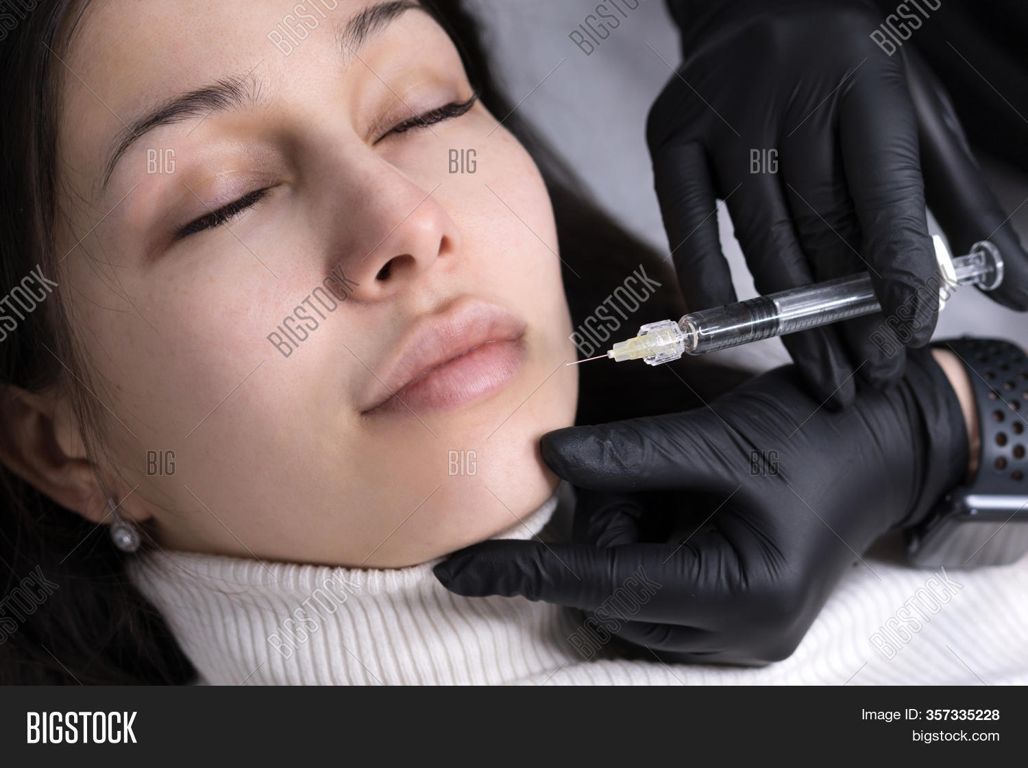 Injections Lips. Image & Photo (Free Trial) Bigstock