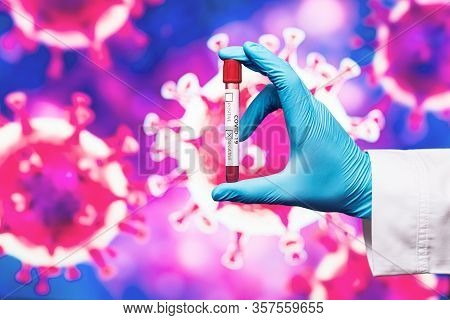 Medical Worker In Gloves Holding Bd Vacutainer In His Hand Against The Background Of The Sars-cov-2 