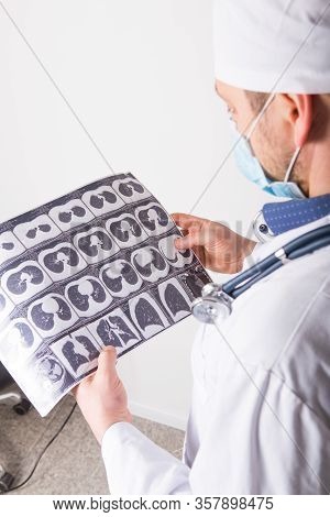 Doctor At Appointment Inspects And Examines Ct Scan Of Chest And Abdominal Cavity. Concept Photo On 