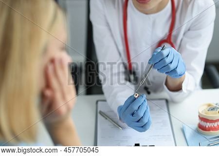 Close-up Of Female Dentist Showing Patient Tooth With Hole Inside And Caries. Woman With Twinge Of T