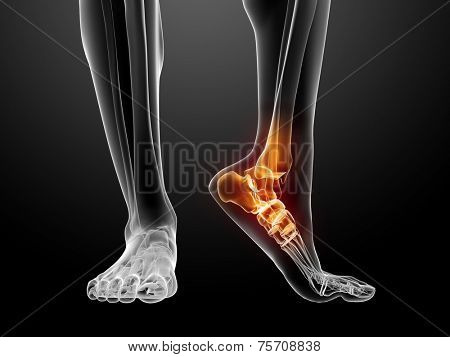 painful foot illustration