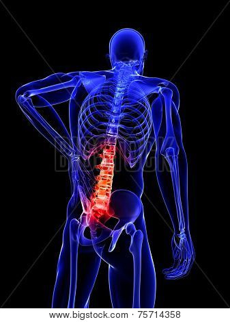 3d rendered medical illustration - backache - x-ray style