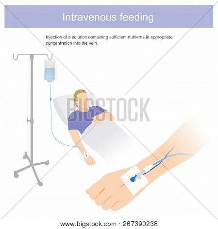 Injection Of Solution Containing Sufficient Nutrient In Appropriate Concentration Into The Vein. Ill