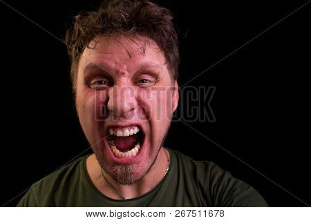 Screaming Man In The Dark. Close-up. Bad Teeth.