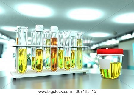 Urine Sample Test For Doping Or Urinary Tract Infection - Lab Proofs In Modern Biochemistry Facility