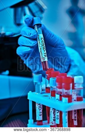 COVID-19 or SARS-CoV-2. Close-up of a microscope with Petri dish and coronavirus test. A scientist makes a study of coronavirus in the laboratory. Innovative technologies in medicine.