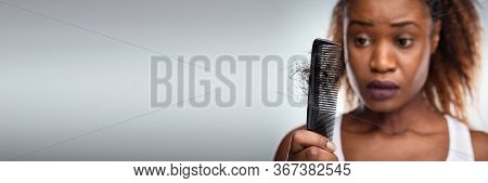 Worried African American Woman Hairfall And Hairloss