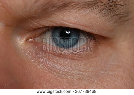 Close-up Unkind Angry Look Man, Eye Young Man. Depression And Anxiety During Pandemic. Focused Atten