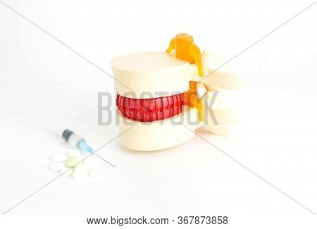 The Spine Is Next To Which Are The Tablets And Syringe. The Concept Of Treatment Of Osteochondrosis 