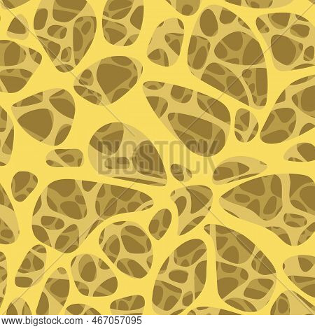 The Pattern In The Abstract Style Is A Light Web. The Lines, Like Divorces, Are Getting Deeper And D