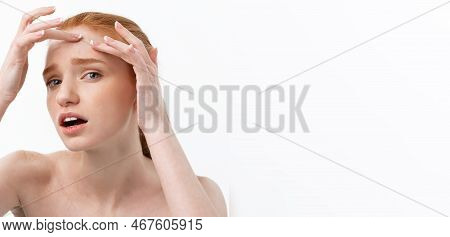 Young Caucsian Woman Squeezes Acne On The Face Of Beauty