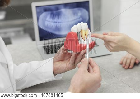 Doctor Showing Patient Educational Model Of Dental Implant In Clinic, Closeup